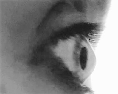 KERATOCONUS FOUNDATION OF SA INT KERATOCONUS FOUNDATION OF SA INT